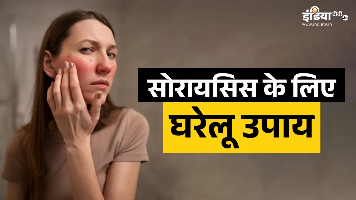 सोरायसिस का इलाज- India TV Hindi