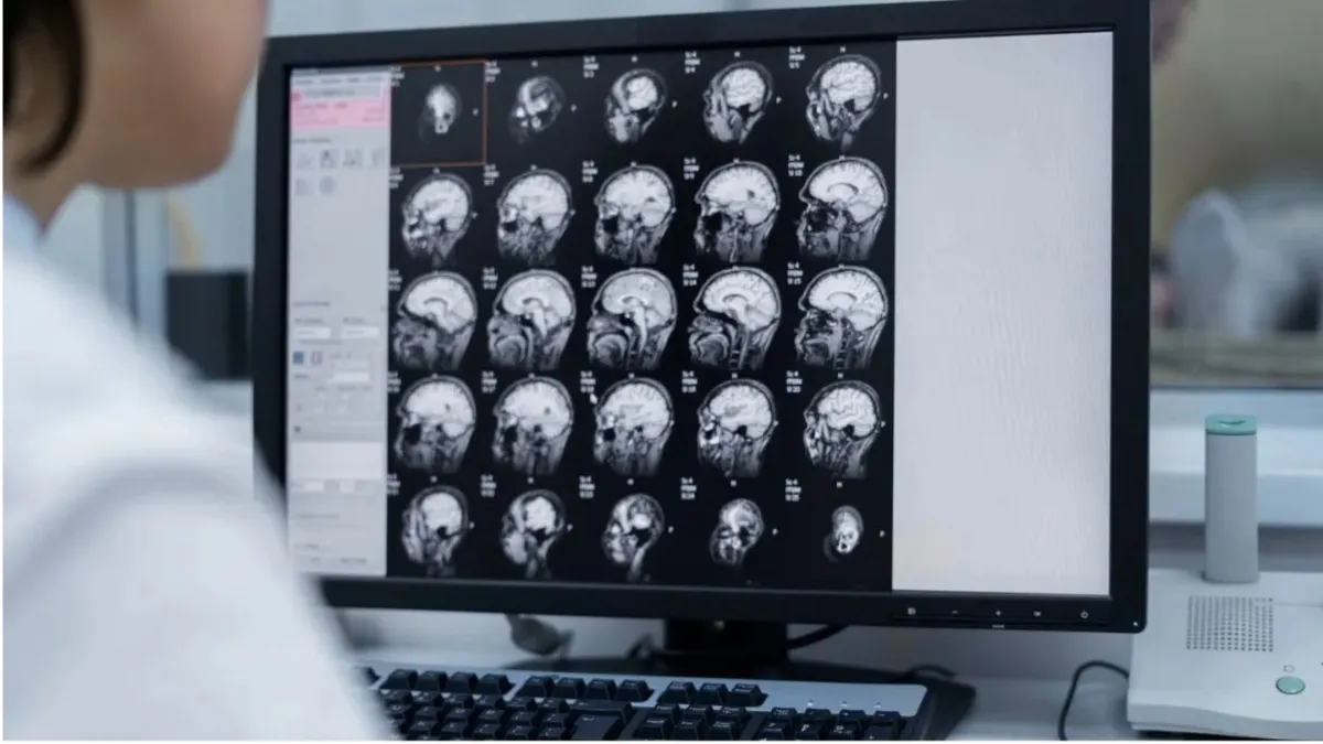 कोविड-19 संक्रमण के बिना भी मस्तिष्क पर असर- India TV Hindi