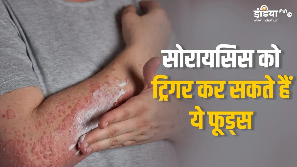सोरायसिस रोग- India TV Hindi