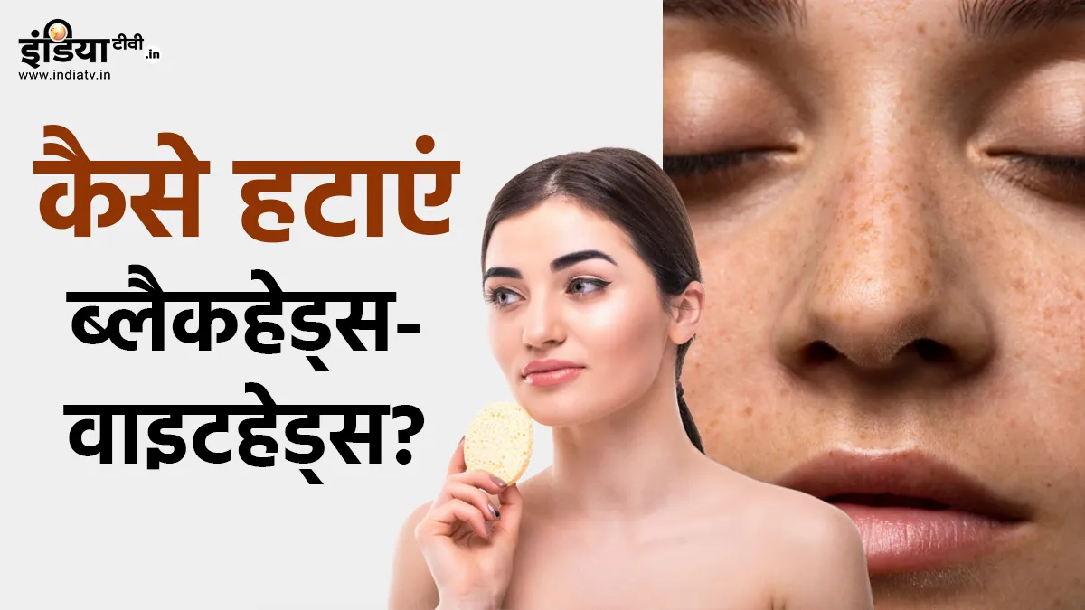 Blackheads-Wightheads Removal- India tv hindi