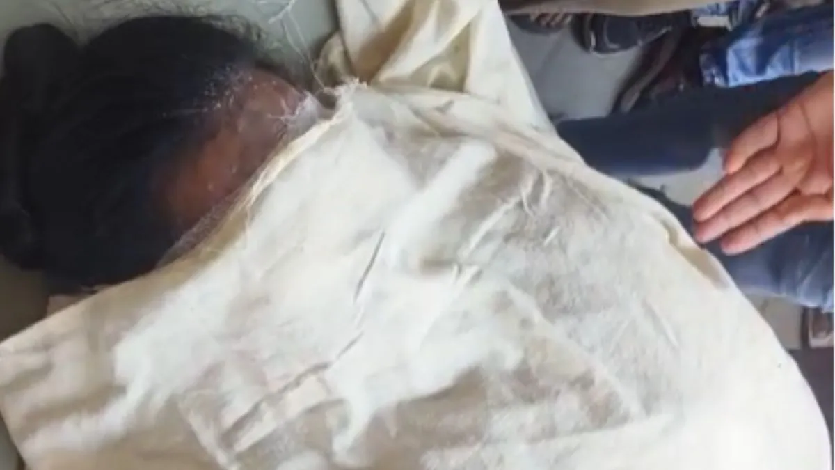 Acid attack- India TV Hindi
