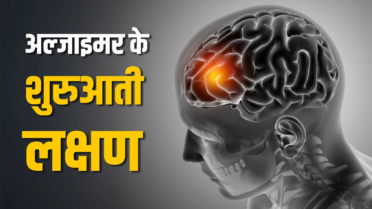 विश्व अल्जाइमर दिवस- India TV Hindi