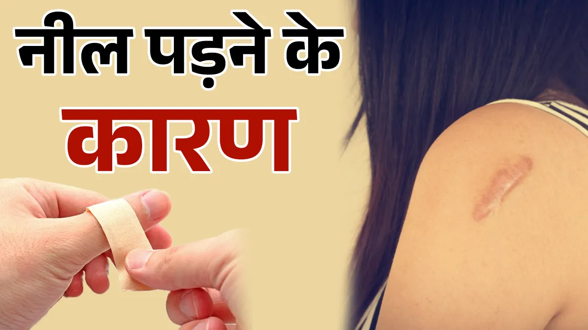 पोषक तत्वों की कमी- India TV Hindi