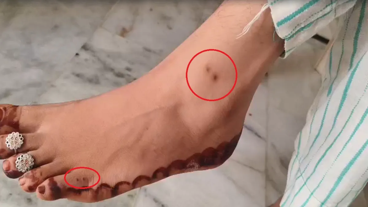 विवाहिता के पैर पर...- India TV Hindi