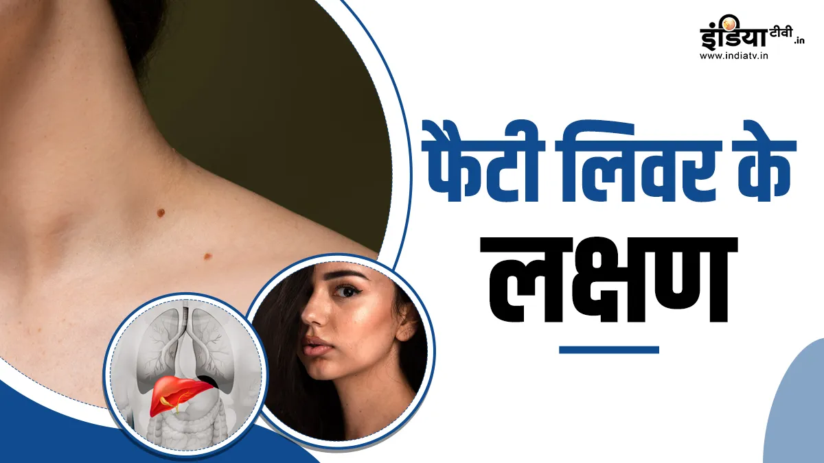 फैटी लिवर- India TV Hindi