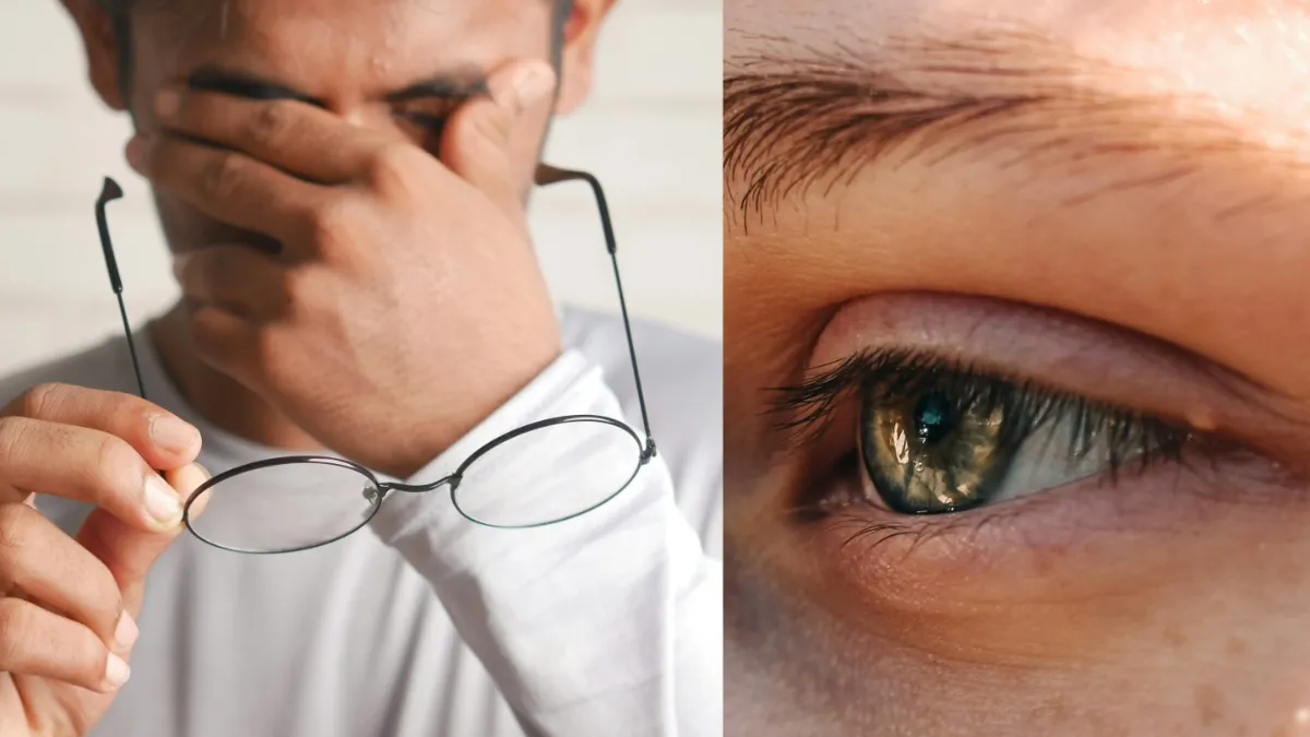 आखों के लिए सबसे जरूरी विटामिन- India TV Hindi