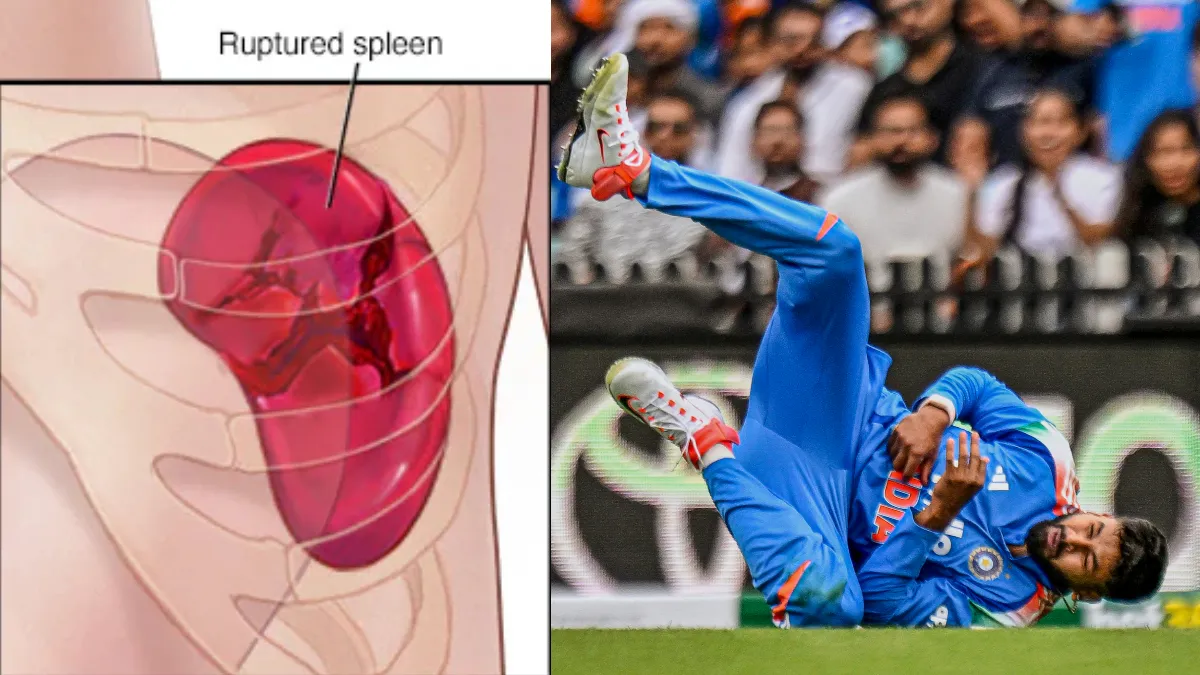 श्रेयस अय्यर को हुई इंजरी क्या है? - India TV Hindi