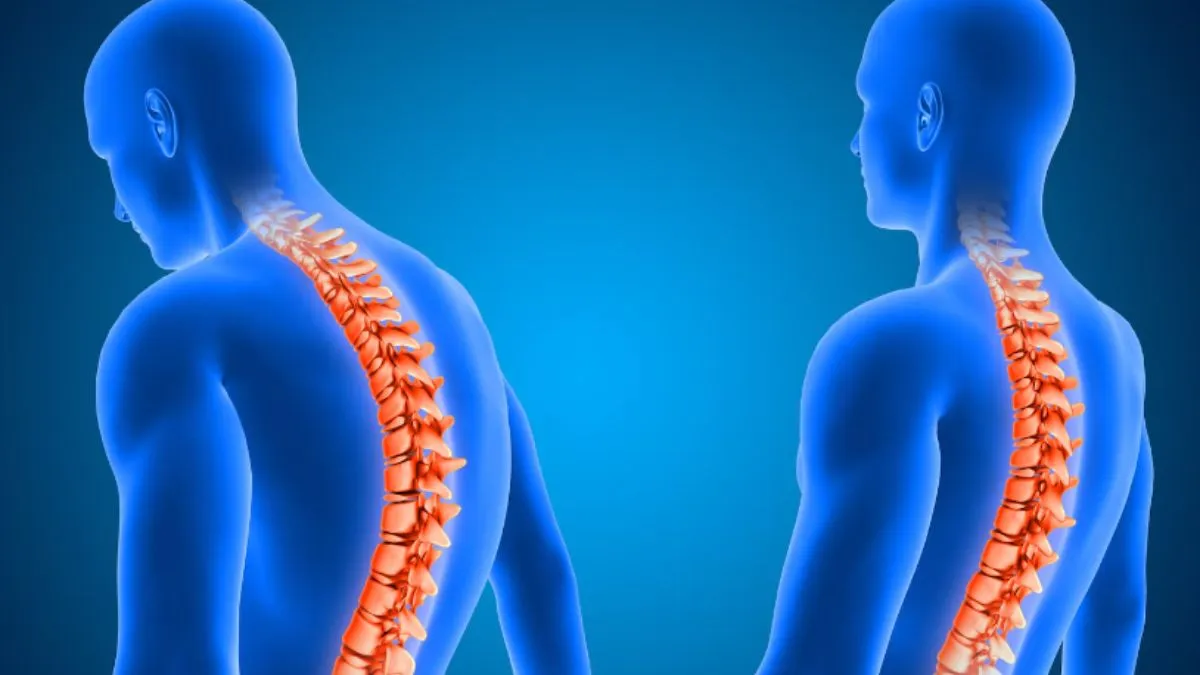 How to get rid of spine problems- India TV Hindi