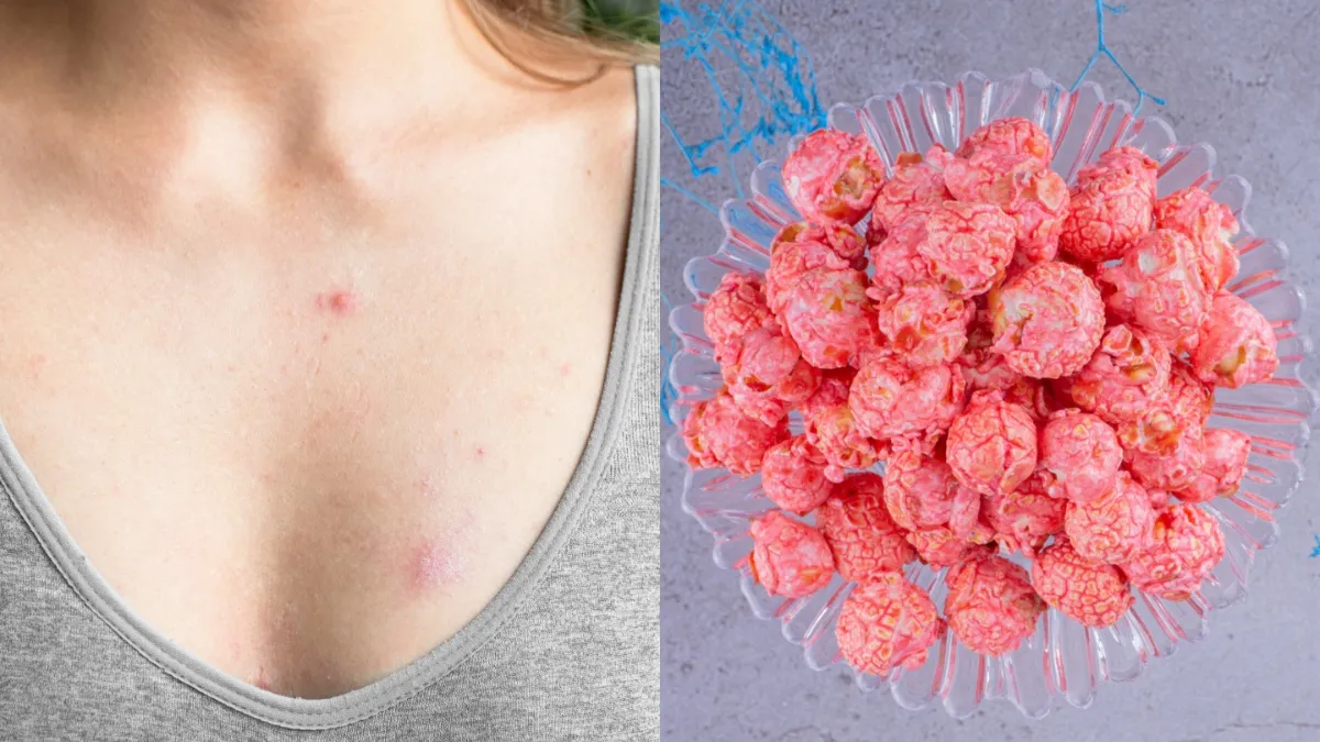 कैंसर की गांठ- India TV Hindi