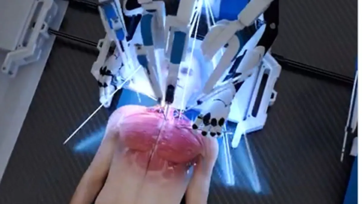 कटे सिर को जोड़ता एआई रोबोट (प्रतीकात्मक फोटो)- India TV Hindi