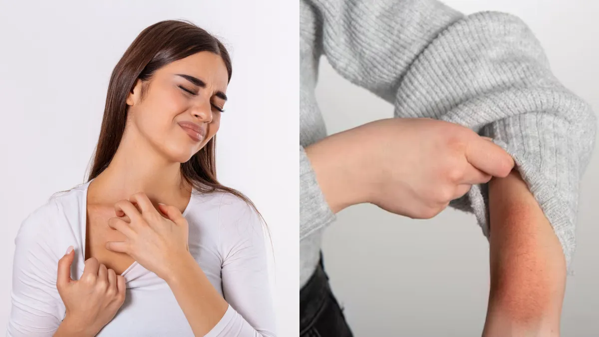 सर्दियों में होने वाली खुजली जैसे दूर करें- India TV Hindi