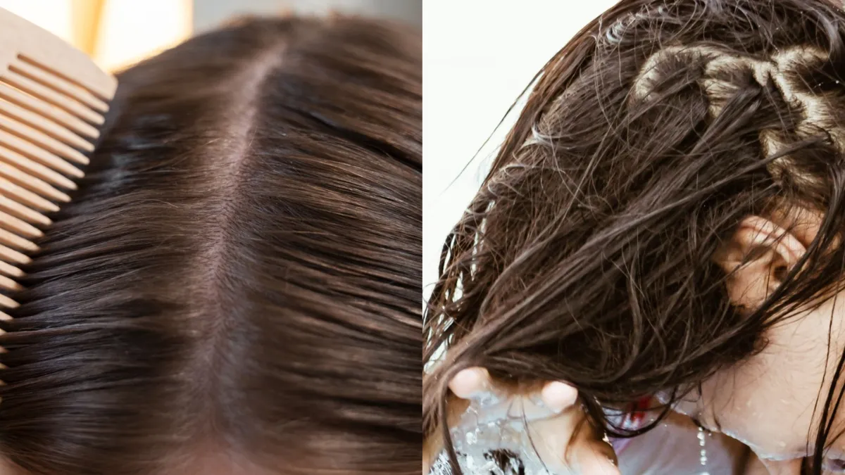 सर्दियों में बालों के झड़ने का कारण- India TV Hindi