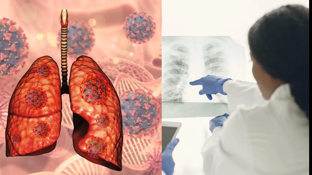 फेफड़ों के संक्रमण का आयुर्वेदिक इलाज- India TV Hindi