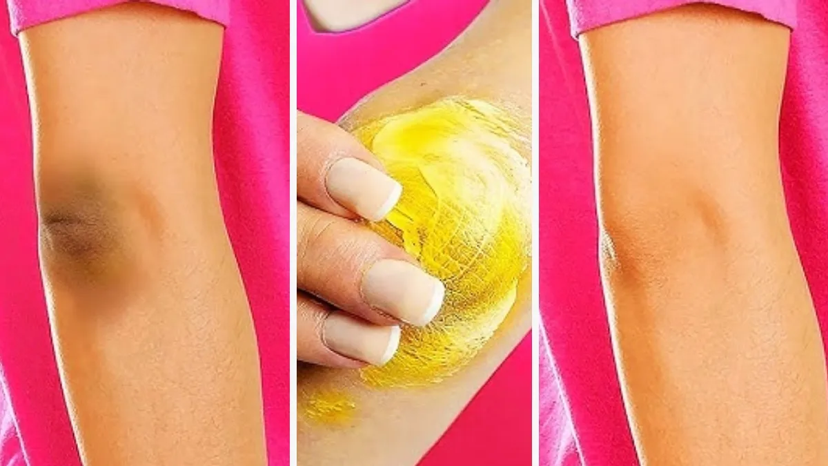 कोहनी के कालेपन को कैसे हटाएं?- India TV Hindi