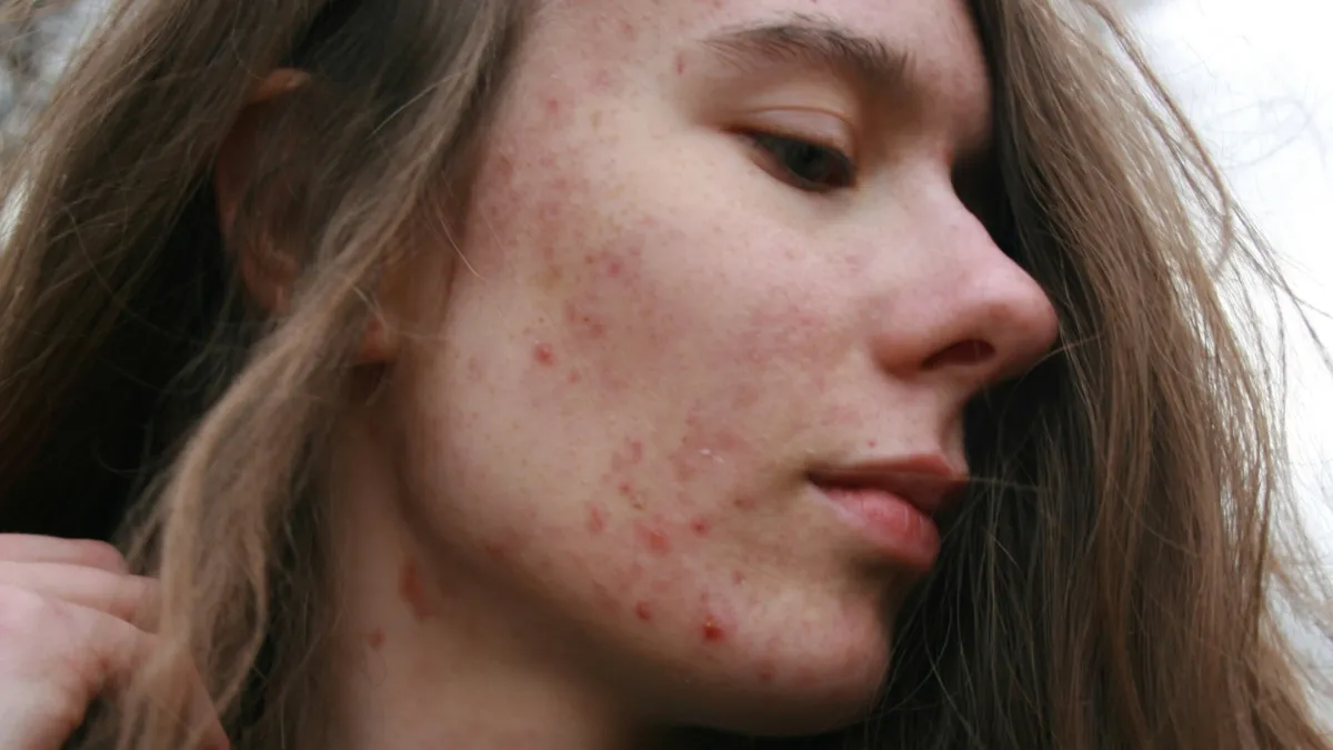 मेटाबॉलिज़्म - India TV Hindi