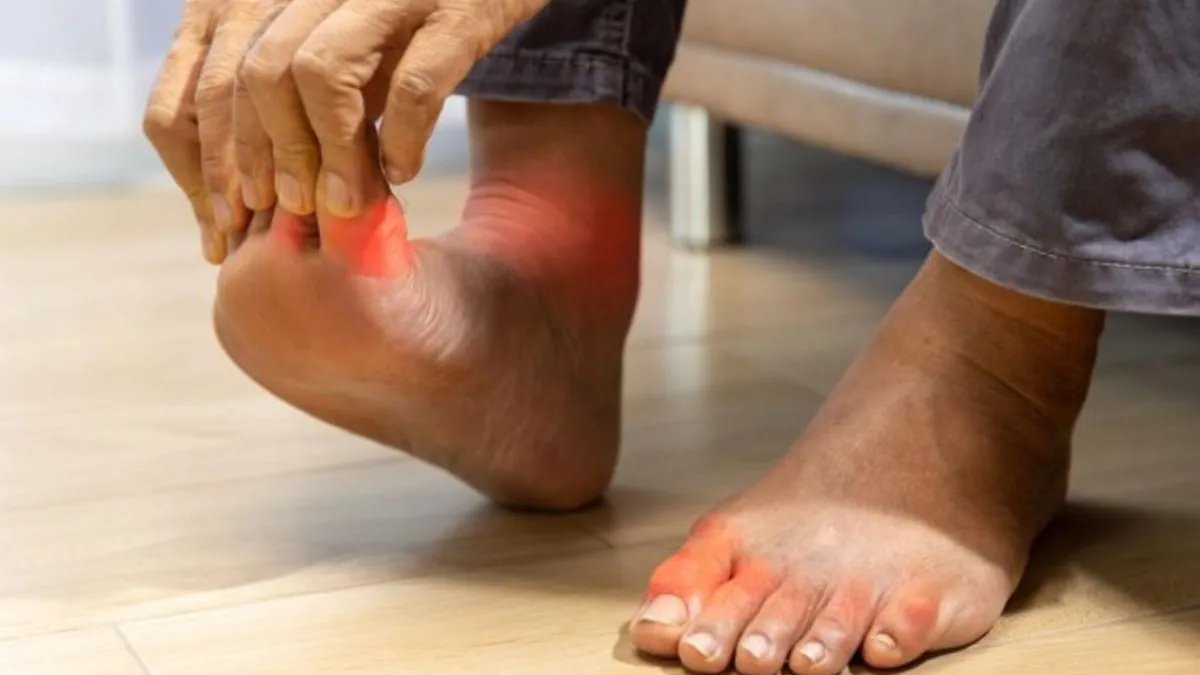 यूरिक एसिड का आयुर्वेदिक उपचार- India TV Hindi