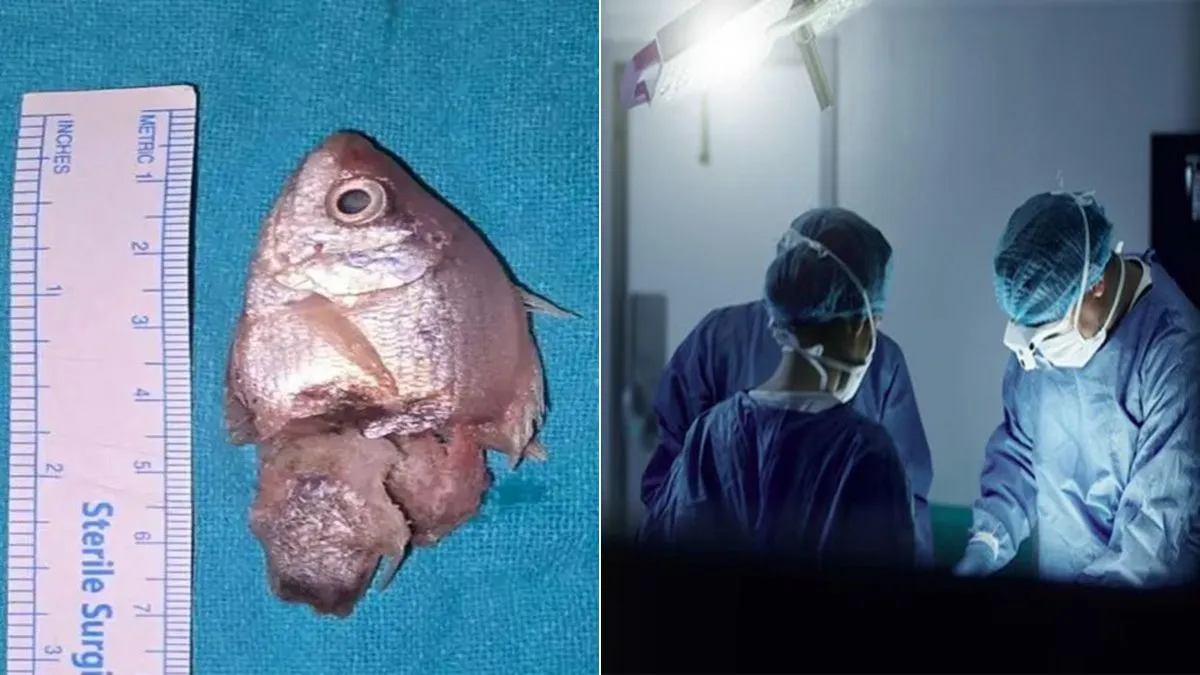 live fish- India TV Hindi