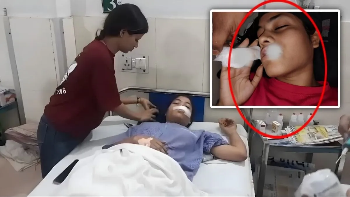 Dog Bite Girl Kanpur- India TV Hindi