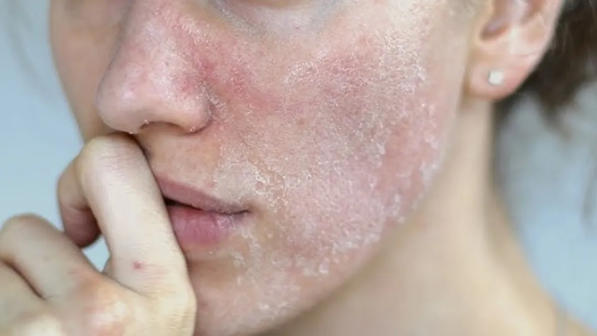 रूखी त्वचा पर क्या लगाएं?- India TV Hindi