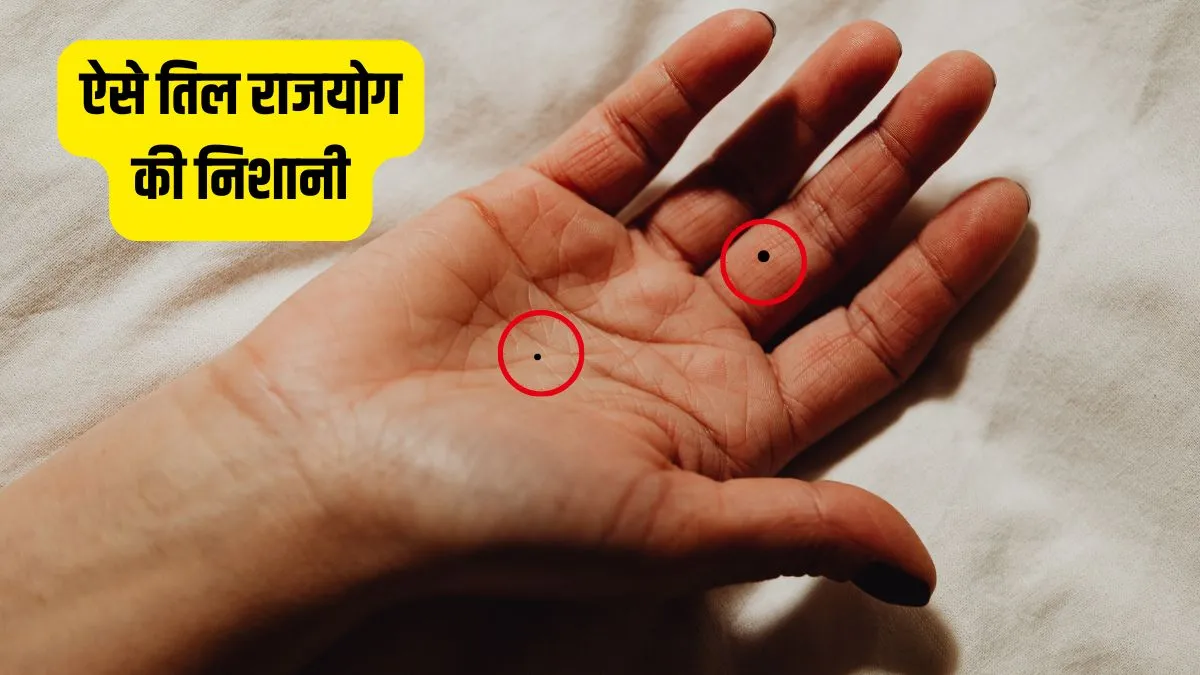 lucky mole on hand- India TV Hindi