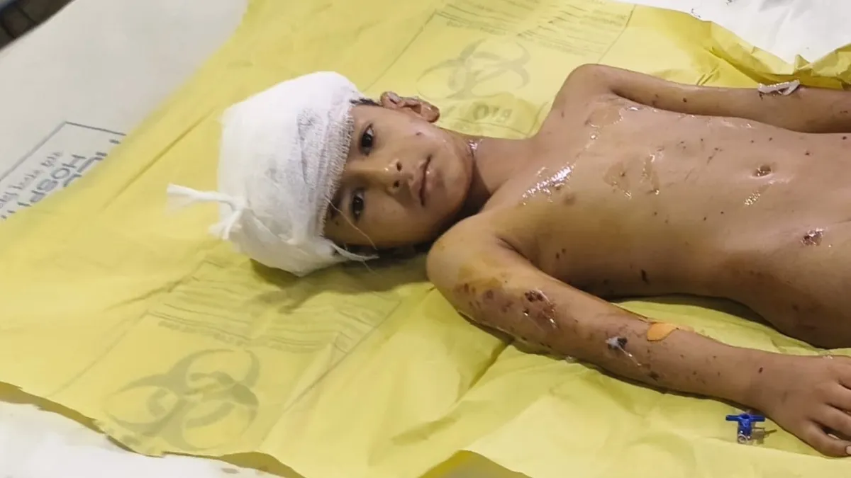 Dog Attack boy- India TV Hindi