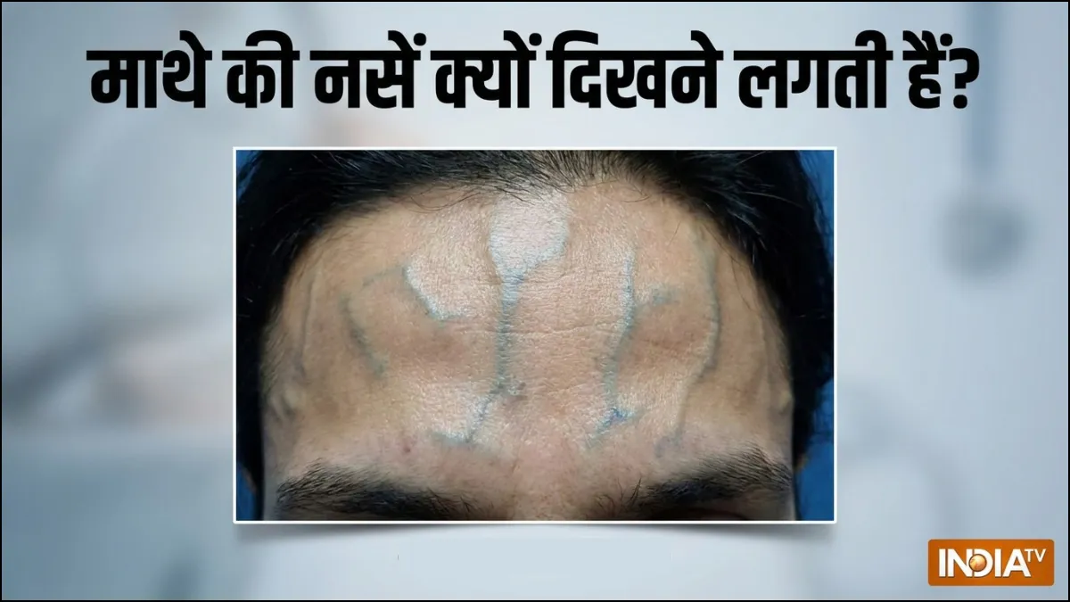 माथे की नसें दिखने का कारण- India TV Hindi