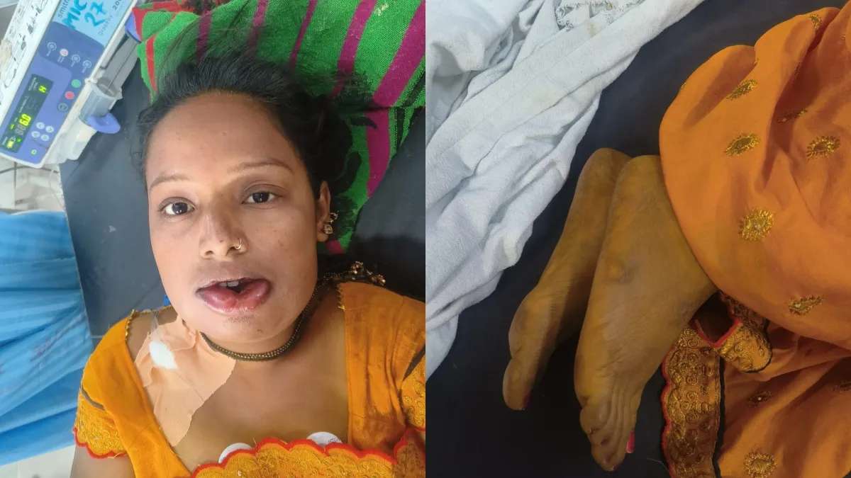 Adulterated turmeric bridge- India TV Hindi