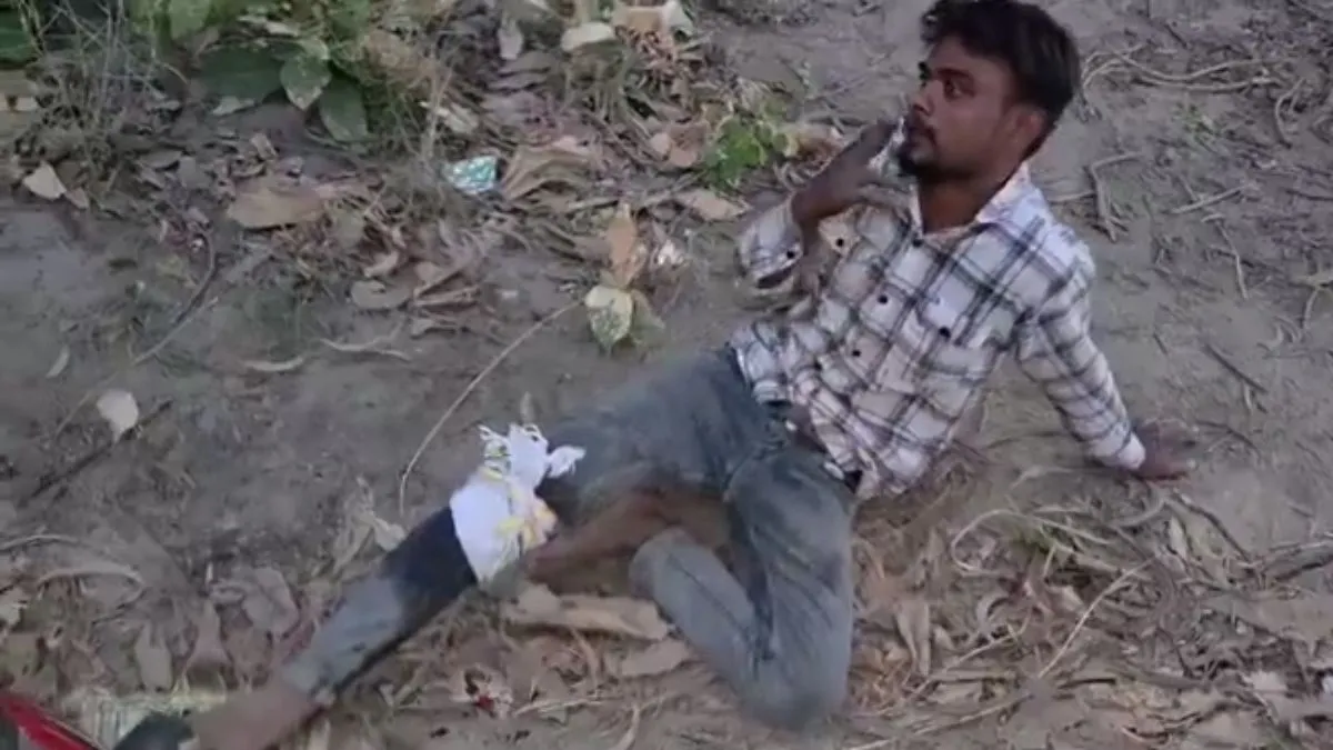 घायल आरोपी ने पुलिस ने मांगी सिगरेट।- India TV Hindi