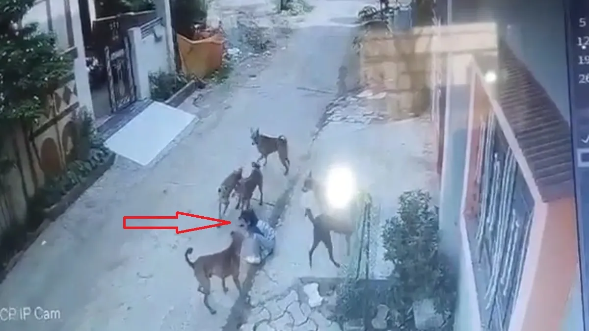 dog attacks school girl- India TV Hindi