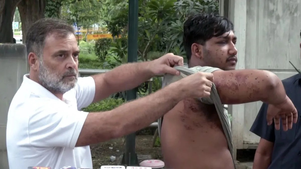 पैलेट गन विवाद पर जांच का ब्योरा लेने DCP ऑफिस पहुंचे राहुल गांधी, दिल्ली  पुलिस से की थी शिकायत - India TV Hindi