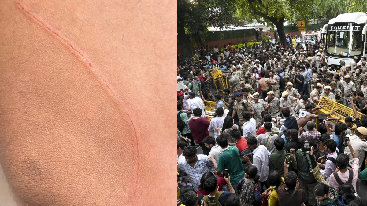 जंतर-मंतर पर प्रदर्शन के दौरान CAPF जवान पर चाकू से हमला, NSUI के कार्यकर्ता पर आरोप