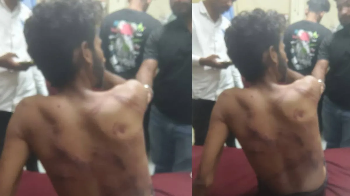 सोशल मीडिया पर लड़की की फर्जी प्रोफाइल बनाकर बिछाया जाल, युवक को मिलने बुलाया, फिर बेल्ट-पाइप से की पिटाई