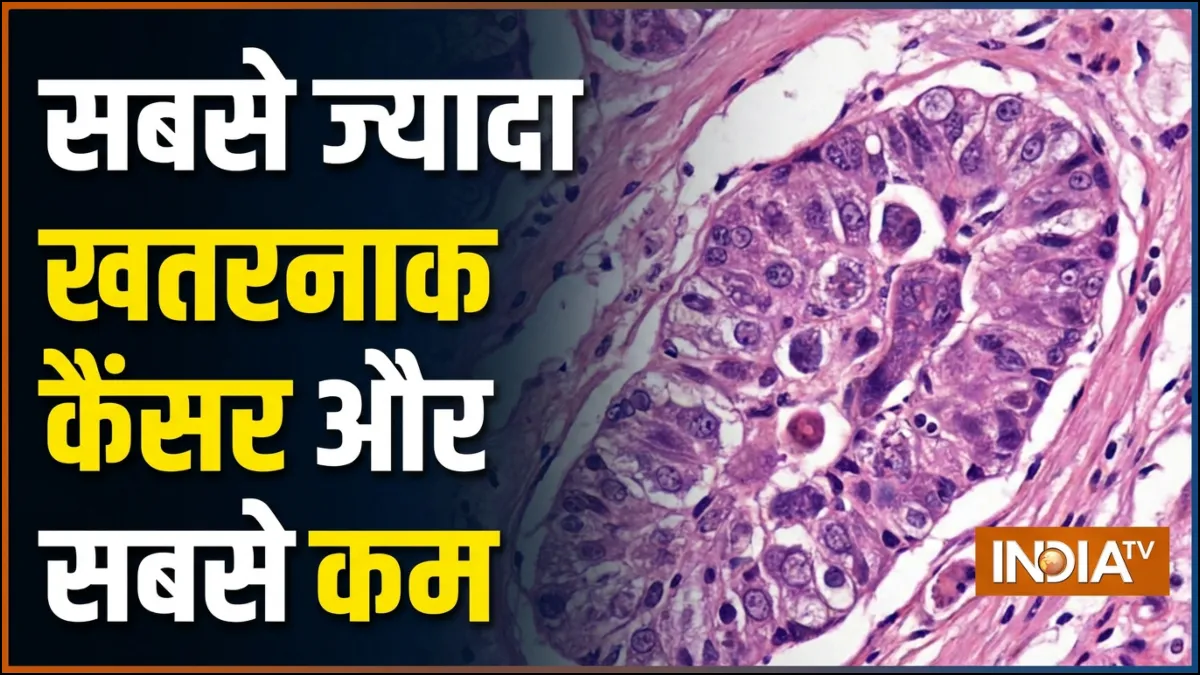 कौन सा कैंसर सबसे ज्यादा खतरनाक माना जाता है और कौन सा कम, फोर्टिस ऑन्कोलॉजिस्ट ने बताया