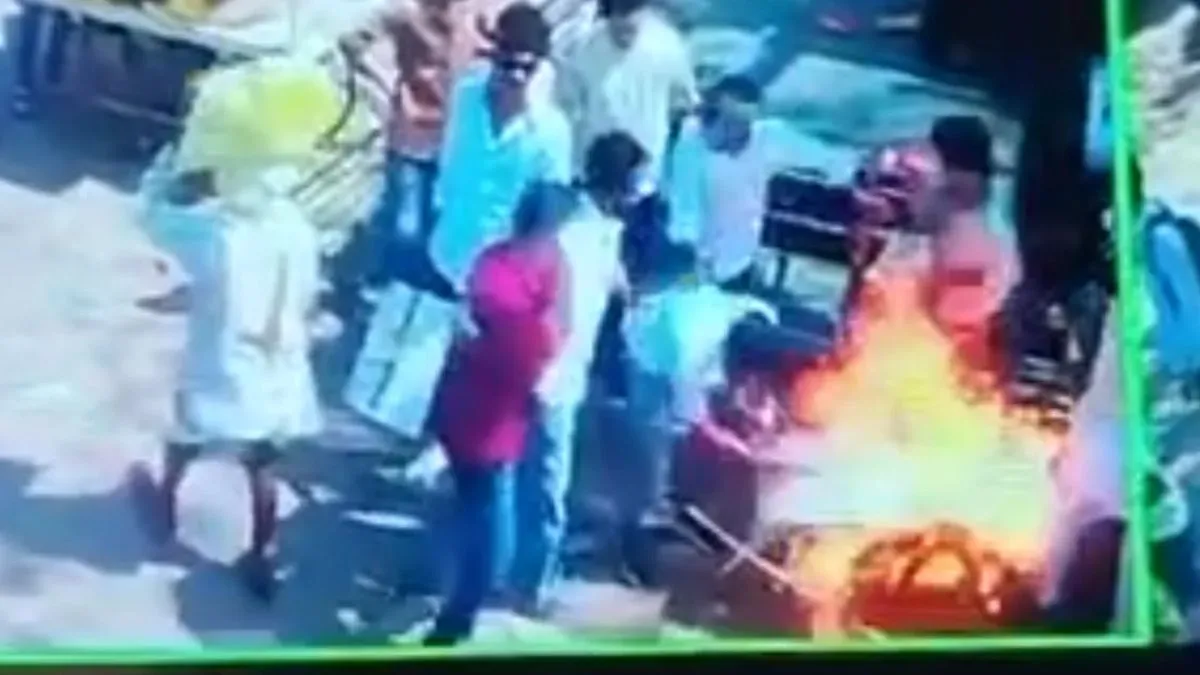 ज्ञानेश कुमार का पुतला जलाते समय झुलसे युवा कांग्रेस जिला अध्यक्ष, NSUI कार्यकर्ता भी आग की चपेट में