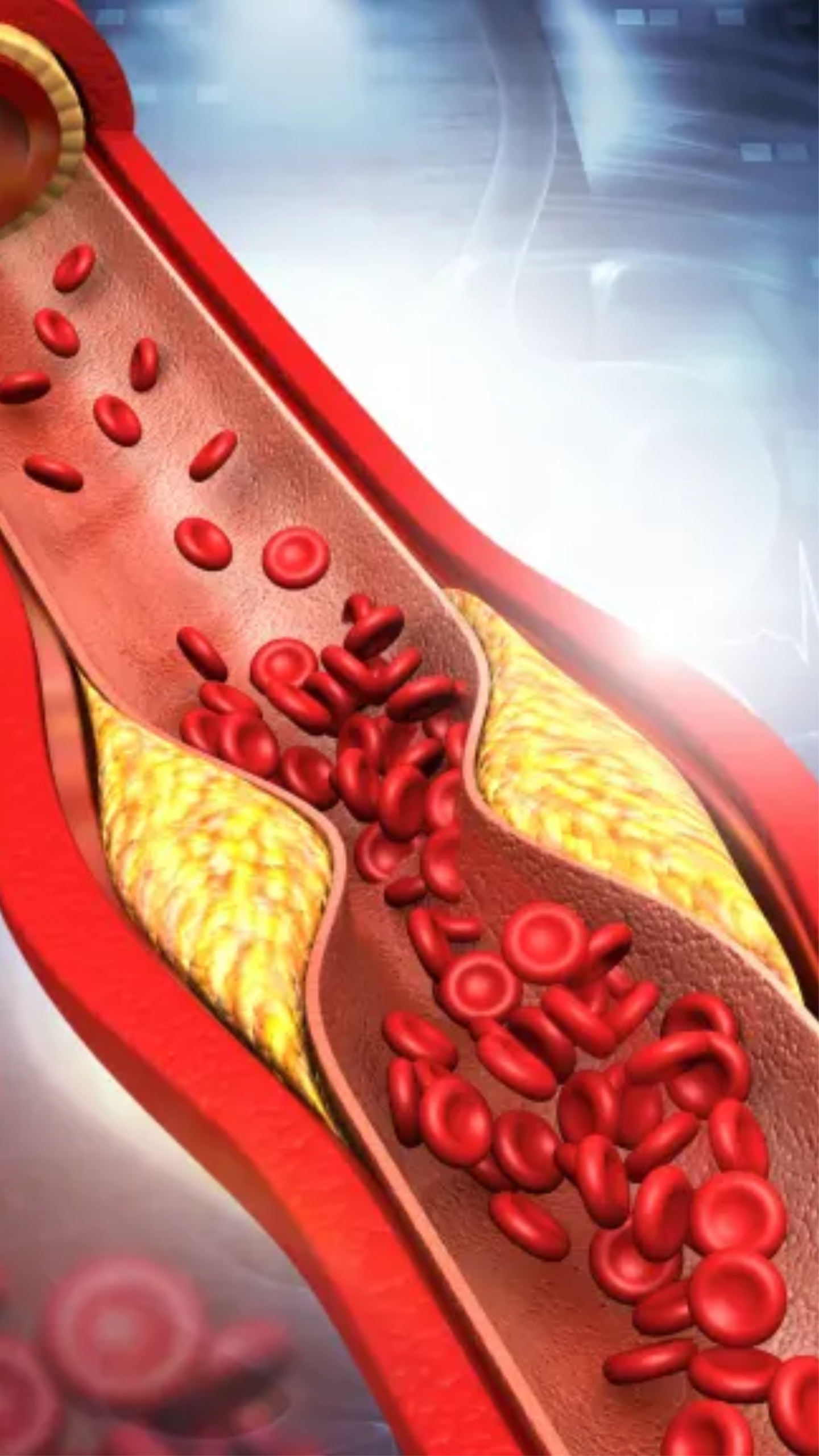 Cholesterol: हाई कोलेस्ट्रॉल लेवल कम करने के लिए खाएं ये फल