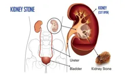 kidney- India TV Hindi