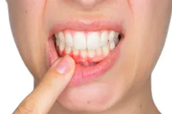 <p>teeth problem</p>- India TV Hindi