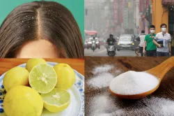 <p>hair problem</p>- India TV Hindi