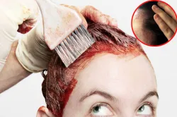 skin allery due to hair dye- India TV Hindi