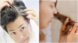 White Hair Problem- India TV Hindi