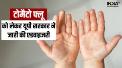 UP government issued advisory on tomato flu- India TV Hindi