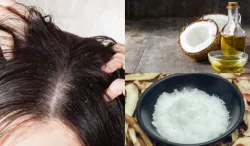 how to remove dandruff- India TV Hindi