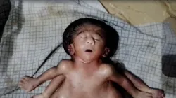 chhapra unique child born with four 4 hand- India TV Hindi