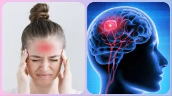 Brain_Tumor_in_Hindi- India TV Hindi