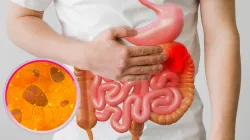 Fatty Liver- India TV Hindi