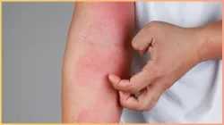 d deficiency symptoms in skin- India TV Hindi