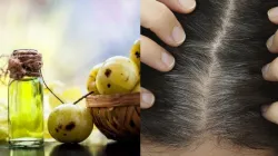 Amla Hair Oil- India TV Hindi