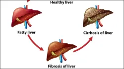 Healthy Liver - India TV Hindi