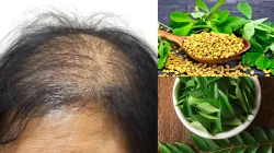 Homemade Hair oil- India TV Hindi