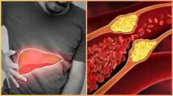 High cholesterol may damage your liver - India TV Hindi